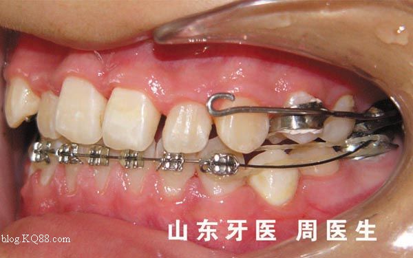 三亿体育官网|复工复产如何做好个人防护?干货来了!(图1) 三亿体育