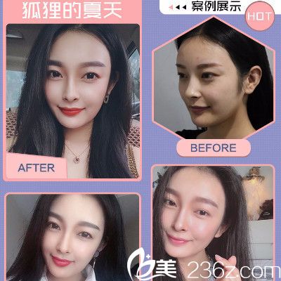 “三亿体育手机版”长安福特曹振宇:客户满意才能让经销商赚到钱(图4) 三亿体育手机版